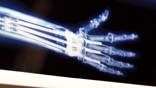 X-Men - Dị Nhân - Hình 2